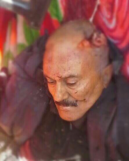 تصویری تایید شده از جنازه علی عبدالله صالح رئيس جمهور سابق يمن (16+)